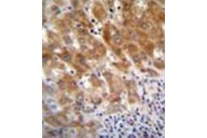 Image no. 1 for anti-Fumarylacetoacetate Hydrolase (Fumarylacetoacetase) (FAH) (AA 14-41), (N-Term) antibody (ABIN952405)