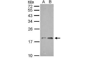 Image no. 2 for anti-NADH Dehydrogenase (Ubiquinone) 1, alpha/beta Subcomplex, 1, 8kDa (NDUFAB1) (C-Term) antibody (ABIN2856829)