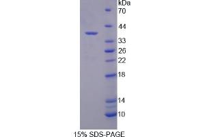 Image no. 1 for Syndecan Binding Protein (Syntenin) 2 (SDCBP2) (AA 1-292) protein (His tag) (ABIN6236961)