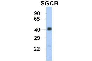 Image no. 2 for anti-Sarcoglycan, beta (43kDa Dystrophin-Associated Glycoprotein) (SGCB) (Middle Region) antibody (ABIN2781779)