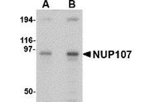 Western Blotting (WB) image for anti-Nucleoporin 107kDa (NUP107) (Middle Region) antibody (ABIN1031028)