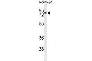 Image no. 2 for anti-Cirrhosis, Autosomal Recessive 1A (Cirhin) (CIRH1A) (N-Term) antibody (ABIN951532)