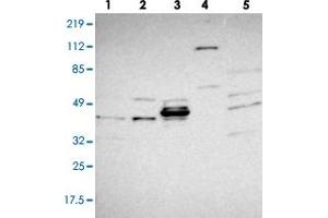 Image no. 4 for anti-Tribbles Pseudokinase 2 (TRIB2) antibody (ABIN5590135)