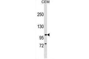 BBS9 Antikörper  (C-Term)