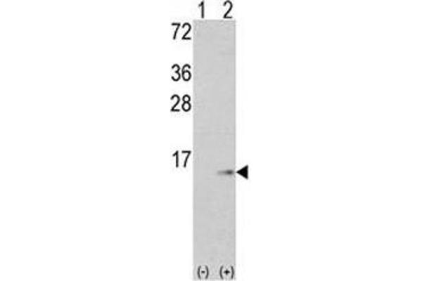 anti-S100 Calcium Binding Protein A6 (S100A6) (AA 37-67) antibody