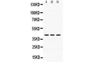Image no. 4 for anti-Dihydroorotate Dehydrogenase (DHODH) (AA 132-173), (N-Term) antibody (ABIN4886562)
