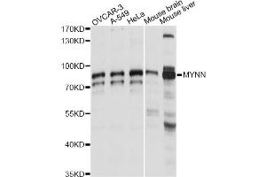 Image no. 1 for anti-Myoneurin (MYNN) antibody (ABIN6291174)