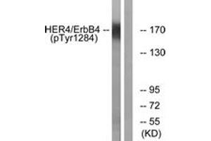Western blot analysis of extracts from HuvEc cells treated with EGF 200ng/ml 30', using HER4 (Phospho-Tyr1284) Antibody.