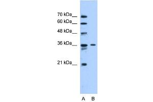 Image no. 1 for anti-Solute Carrier Family 35 (UDP-N-Acetylglucosamine (UDP-GlcNAc) Transporter), Member A3 (SLC35A3) (Middle Region) antibody (ABIN2781628)