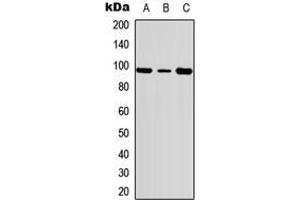 Image no. 2 for anti-FER Tyrosine Kinase (FER) (Center), (pTyr402) antibody (KLH) (ABIN2972773)