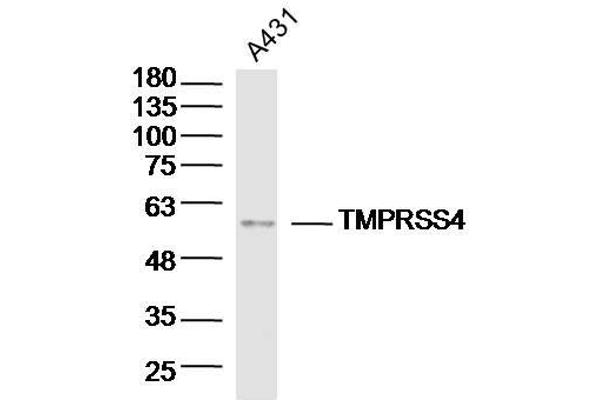 anti-Transmembrane Protease, serine 4 (TMPRSS4) (AA 84-130) antibody