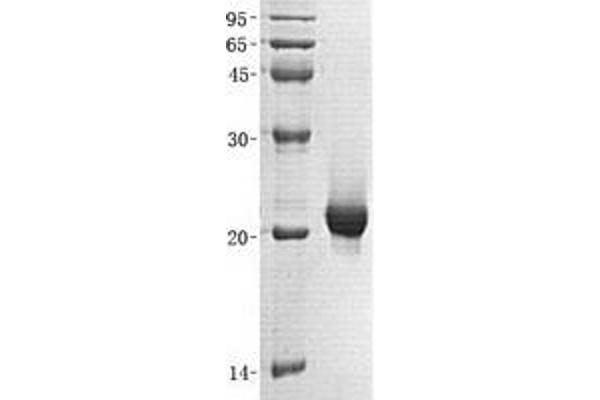 SENP7 Protein (Transcript Variant 2) (His tag)