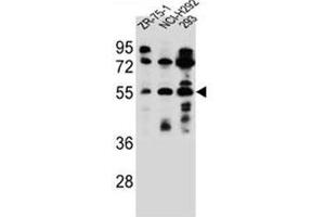 Image no. 2 for anti-Fucosyltransferase 6 (Alpha (1,3) Fucosyltransferase) (FUT6) (AA 19-49), (N-Term) antibody (ABIN952400)