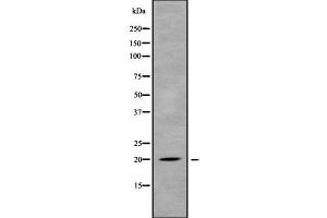 MED30 antibody  (Internal Region)