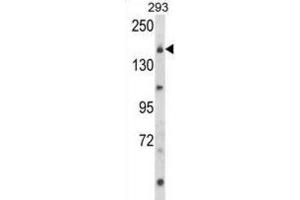 Image no. 1 for anti-Unc-13 Homolog B (UNC13B) antibody (ABIN3003956)