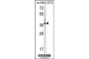 Image no. 1 for anti-Actin Related Protein 2/3 Complex, Subunit 1B, 41kDa (ARPC1B) (AA 159-188) antibody (ABIN652700)