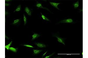 Image no. 2 for anti-Cold Shock Domain Protein A (CSDA) (AA 1-372) antibody (ABIN521975)