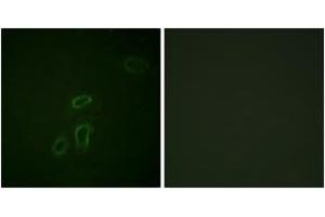 Image no. 2 for anti-L1 Cell Adhesion Molecule (L1CAM) (AA 1147-1196) antibody (ABIN1532555)
