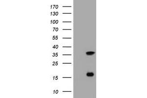 Image no. 5 for anti-Thymidylate Synthetase (TYMS) antibody (ABIN1501589)