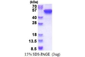 Image no. 1 for Keratin 16 (KRT16) (AA 1-473) protein (His tag) (ABIN5853597)