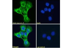 Image no. 5 for anti-Caveolin 1, Caveolae Protein, 22kDa (CAV1) (Internal Region) antibody (ABIN185421)