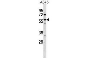 Image no. 1 for anti-Sorting Nexin 2 (SNX2) (AA 456-485), (C-Term) antibody (ABIN954888)