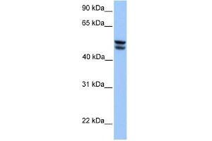 Image no. 1 for anti-3-Oxoacid CoA Transferase 1 (OXCT1) (Middle Region) antibody (ABIN633896)
