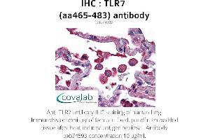 Image no. 2 for anti-Toll-Like Receptor 7 (TLR7) (AA 465-483) antibody (ABIN5693731)