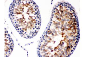 anti-Second Mitochondria-Derived Activator of Caspase (DIABLO) (AA 56-239) antibody