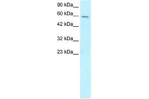Image no. 2 for anti-Forkhead Box G1 (FOXG1) (N-Term) antibody (ABIN629820)