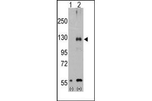 Image no. 1 for anti-Transient Receptor Potential Cation Channel, Subfamily M, Member 8 (TRPM8) (Middle Region) antibody (ABIN360716)