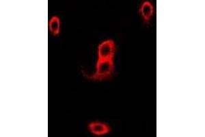 Image no. 3 for anti-Neutrophil Cytosolic Factor 2 (NCF2) (full length) antibody (ABIN6004836)