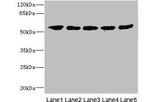 Image no. 1 for anti-Interleukin 28 Receptor, alpha (Interferon, lambda Receptor) (IL28RA) (AA 21-228) antibody (ABIN6098644)