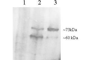 Image no. 1 for anti-Proprotein Convertase Subtilisin/kexin Type 9 (PCSK9) (C-Term) antibody (ABIN185371)