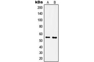 Image no. 3 for anti-Inositol 1,3,4,5,6-Pentakisphosphate 2-Kinase (IPPK) (N-Term) antibody (ABIN2707595)