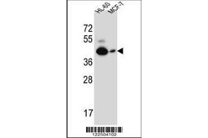 anti-Calcitonin Receptor (CALCR) (AA 465-494) antibody