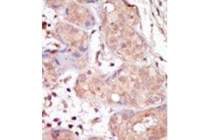 Image no. 1 for anti-Male Germ Cell-Associated Kinase (MAK) (C-Term) antibody (ABIN359695)