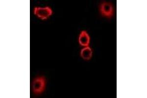 Image no. 3 for anti-Thioredoxin-Like 1 (TXNL1) antibody (ABIN2967123)