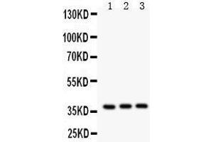 Anti- IL3 antibody, Western blotting All lanes: Anti IL3  at 0.