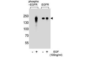 Image no. 4 for anti-Epidermal Growth Factor Receptor (EGFR) (pTyr1172) antibody (ABIN3030845)