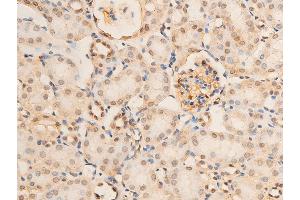 Image no. 1 for anti-Nuclear Factor-kB p65 (NFkBP65) (pSer536) antibody (ABIN6255402)