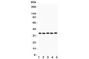 Image no. 3 for anti-Homeobox A11 (HOXA11) (AA 74-245) antibody (ABIN3031247)