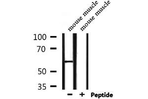 Image no. 2 for anti-CD151 (CD151) antibody (ABIN6260576)