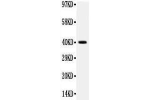 Image no. 1 for anti-Integrin beta 4 (ITGB4) (AA 28-266) antibody (ABIN3042525)