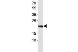 Image no. 3 for anti-Erythropoietin (EPO) (AA 20-48) antibody (ABIN3030867)