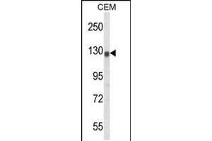 Image no. 1 for anti-Potassium Voltage-Gated Channel, Subfamily H (Eag-Related), Member 2 (KCNH2) (AA 861-888) antibody (ABIN5533125)