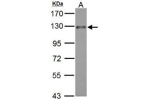 WB Image ADAM17 antibody [C2C3], C-term detects ADAM17 protein by Western blot analysis.