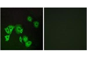 Image no. 1 for anti-Transcription Termination Factor, RNA Polymerase II (TTF2) (AA 51-100) antibody (ABIN1535496)