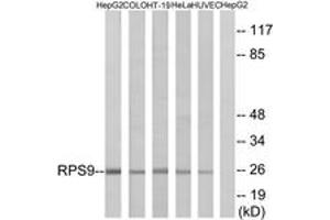 RPS9 antibody  (AA 31-80)