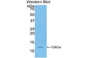 Image no. 1 for anti-S100 Calcium Binding Protein A5 (S100A5) (AA 1-92) antibody (ABIN1078505)